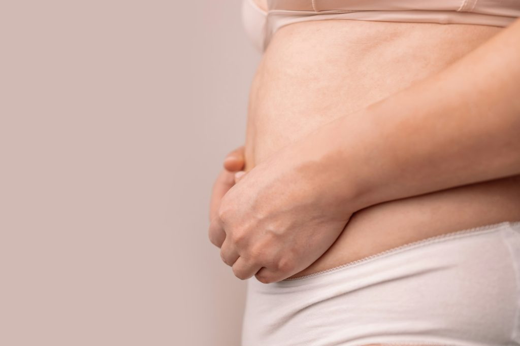Close up cropped of unrecognizable fat female belly, woman holding skin to check cellulite.
