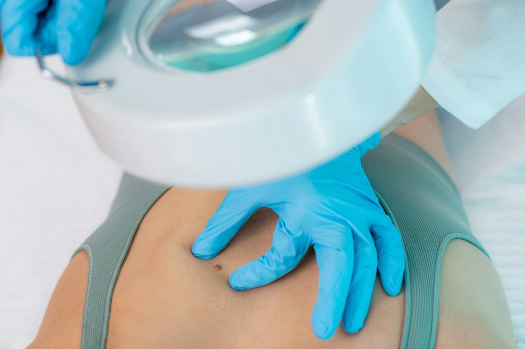 Dermatologist Examines Patient's Skin Mole.