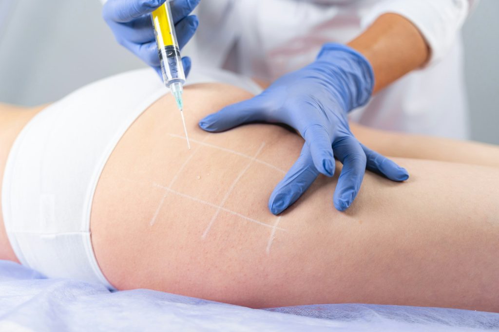 Doctor giving an injection into her patients problem area